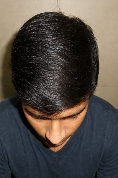 After