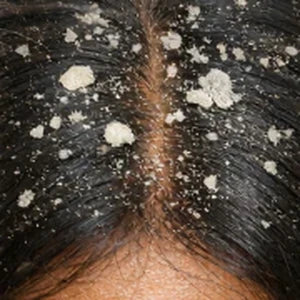 Heavy flakes