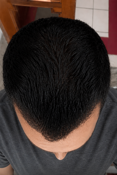 After