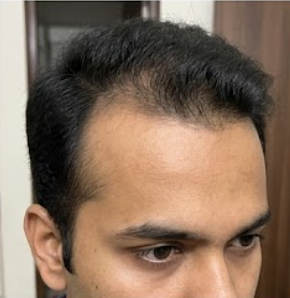 Before