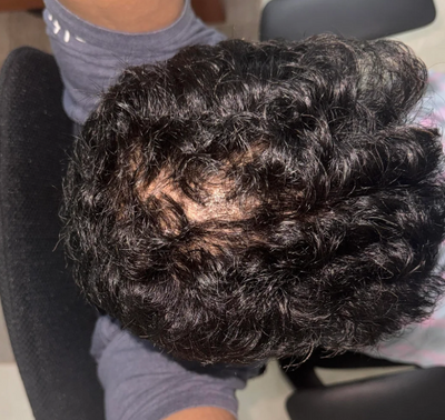 Month 1
