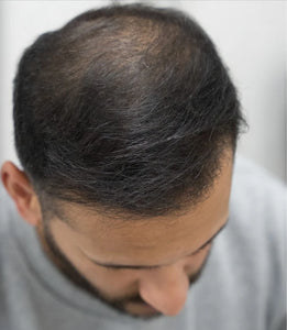 After