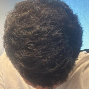 After