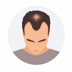Stage 3