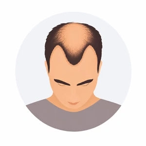 Stage 4