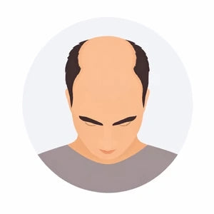 Stage 5